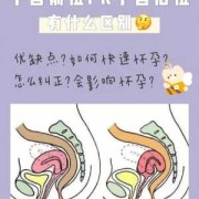孕期子宫前位（子宫前位和后位有哪些不同）