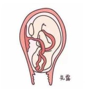 胎儿过月不生的因素（胎儿过月不生的因素有哪些）