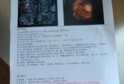 胎儿集合系统分离（四维彩超显示我胎儿左肾集合系统分离7mm，要紧吗）