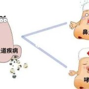 孕期鼻炎症状（孕期鼻炎症状有哪些）