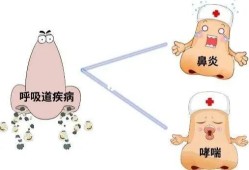 孕期鼻炎症状（孕期鼻炎症状有哪些）