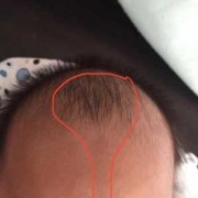 婴儿鼻梁高低怎么看,胎儿鼻梁低平