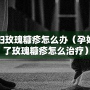 孕期玫瑰糠疹（玫瑰糠疹的治疗方法有哪些）