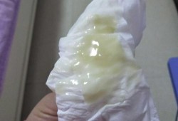 备孕期白带少（备孕期白带少）
