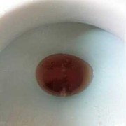孕期尿偏黄（孕妇尿液发黄怎么办）