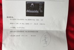 38周加5天胎儿图片（孕38周胎心164好不好?怎么通过胎心来判断宝宝的发育情况）