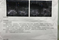 胎儿彩超检查（胎儿彩超检查多少钱一次）