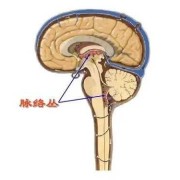胎儿右侧脉络丛囊肿是什么意思（17周胎儿右侧脉络丛囊肿是什么意思）