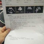 胎儿眼距小（胎儿眼距小有什么危害）