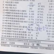 孕妇地中海贫血检查有哪些,孕期地中海贫血有什么影响