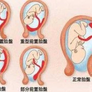 前壁胎儿图片（胎盘前壁与胎动有关系吗）