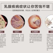 孕期乳腺增生（乳腺增生样改变是什么意思）