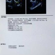 怀孕期彩超做多了好不好，在整个孕期一般会做多少次彩超,孕期经常做彩超对胎儿有没有影响