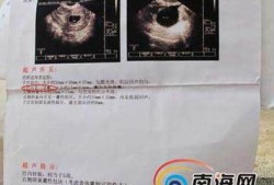 9个月胎儿发育标准b超（20个月的宝宝发育标准是什么？咋样算是发育比较正常）