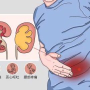 孕期肾积水（孕晚期，双肾积水怎么回事）