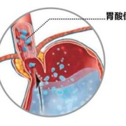 宝宝在肚子里几个月长头发,怀孕几个月胎儿长头发开始烧心