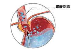 宝宝在肚子里几个月长头发,怀孕几个月胎儿长头发开始烧心