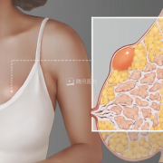 孕期乳房肿块（孕期乳房肿块变大变硬）