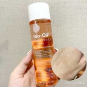 妊娠纹痒，用什么擦,孕期妊娠纹痒怎么办呢