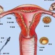 宫腔有积血对胎儿有影响吗,怀孕初期出血对胎儿有影响吗?