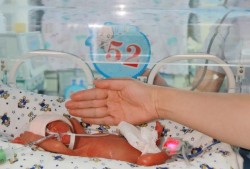 24周的胎儿图片（胎儿双顶径60mm孕24周胎儿头有多大）