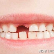 胎儿埋在哪比较合适（俗话说上牙掉了扔房顶,下牙掉了扔哪里）
