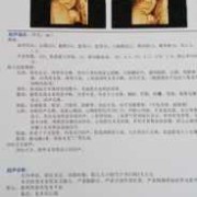 怀孕23周胎儿彩超（孕23周，四维彩超有个NF值是什么）
