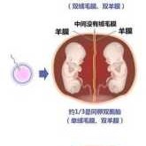 双胞胎的脐带是怎么连接的,胎儿的脐带连接图片