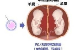 双胞胎的脐带是怎么连接的,胎儿的脐带连接图片