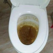 怀孕期间大便干燥怎么办（大便太干燥马桶堵了怎么办）