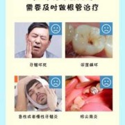孕期牙齿坏了怎么办,孕期根管治疗危害