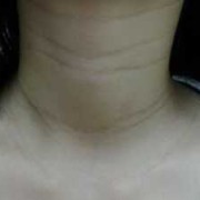 孕期脖子变黑长纹（孕妇脖子变黑是怎么回事呢？正常的吗）