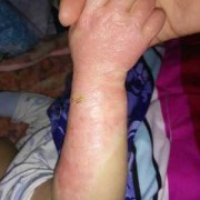 怀孕烫头发有影响吗,孕妇被烫伤影响胎儿吗视频