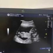 孕16周胎儿稳定了吗（孕16周胎儿稳定了吗正常吗）