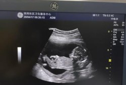 孕16周胎儿稳定了吗（孕16周胎儿稳定了吗正常吗）