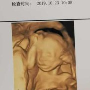 20周的胎儿有多大（怀孕20周的胎儿有多大，估算有2斤会太小了吗）