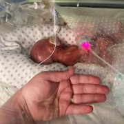22周胎儿视频（怀孕22周小脑横径范围是多少）