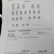 羊水穿刺检查核型分析和基因芯片的有什么不一样吗,胎儿基因芯片检查