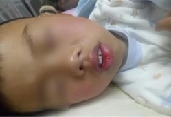 胎儿呼吸（刚出生婴儿用嘴巴呼吸正常吗,不正常会有什么后果吗）