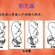 胎儿先露头是什么意思（胎儿先露头是什么意思）
