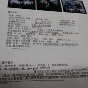 视频彩铃心动会员收费吗,胎儿超声心动多少钱