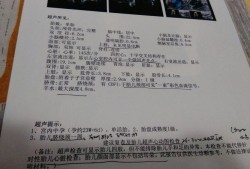 视频彩铃心动会员收费吗,胎儿超声心动多少钱