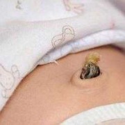 孕期肚脐眼脏（孕妇肚脐眼脏，怎么清洗）