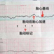 胎儿胎心160正常吗（胎儿胎心160正常吗?）