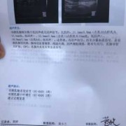 孕期乳房变大如何保持呢？吃什么好呢,孕期乳腺增大对乳腺彩超有影响吗
