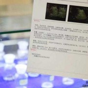 胎儿巨结肠（胎儿巨结肠B超可以检查出来吗）