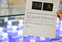 胎儿巨结肠（胎儿巨结肠B超可以检查出来吗）