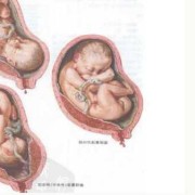 我想问一下胎盘距离宫颈口多少厘米才算前置胎盘呀,前置胎盘的胎儿偏小吗