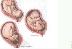 我想问一下胎盘距离宫颈口多少厘米才算前置胎盘呀,前置胎盘的胎儿偏小吗