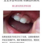 孕妇吃什么胎儿会白（宝宝牙齿有白斑怎么回事？白斑是什么原因引起的呢）